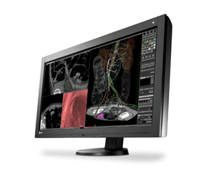 Image: The RadiForce RX840 monitor (Photo courtesy of Eizo Nanao).